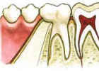 The Anatomy of Teeth and Jaws | Recurso educativo 752665